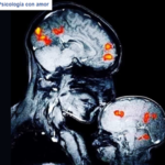Emocje mózgu zapisane na zdjęciu. Oto co ujawniła neurolog