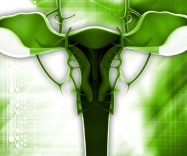 Endometrioza - przyczyny, objawy, leczenie