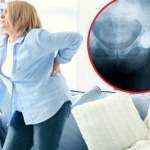 Endoproteza. W przyszłości może dotyczyć większości społeczeństwa