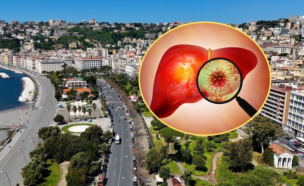 Epidemia WZW A we włoskim kurorcie. Zakażenie po zjedzeniu określonego produktu