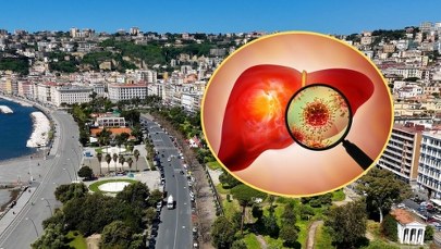 Epidemia WZW A we włoskim kurorcie. Zakażenie po zjedzeniu określonego produktu