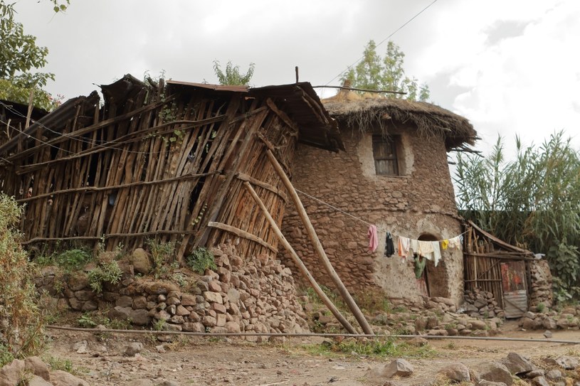 Etiopia. Polio jest ciężką chorobą, która prowadzi m.in. do porażenia mięśni /123RF/PICSEL