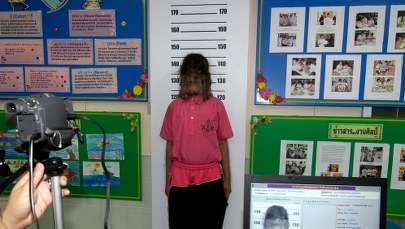 Fatalna pomyłka producenta. W Hiszpanii lek wywołał "zespół wilkołaka" u dzieci