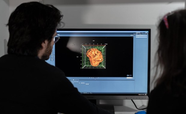 Fenofibrat - kolejny obiecujący lek w walce z koronawirusem