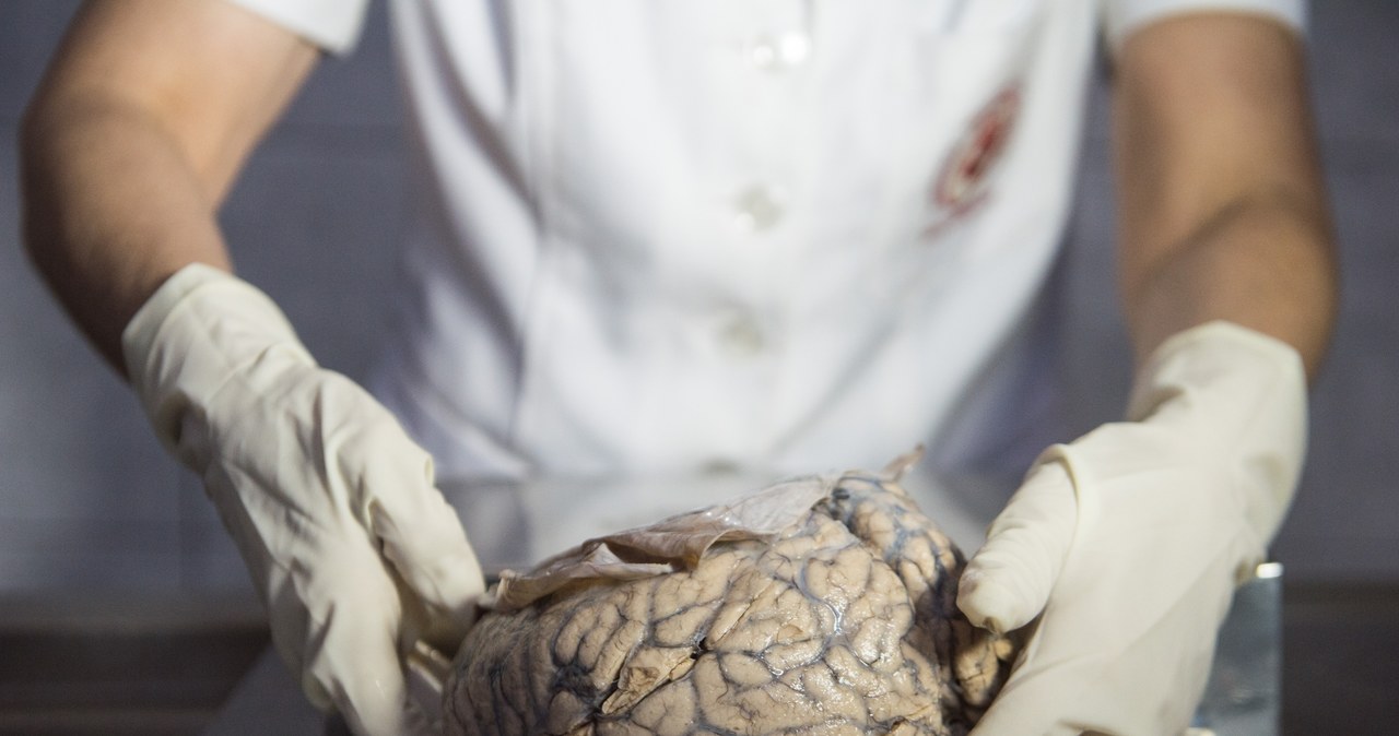 Firma Nectome opracowała proces witryfikacji mózgów /AFP