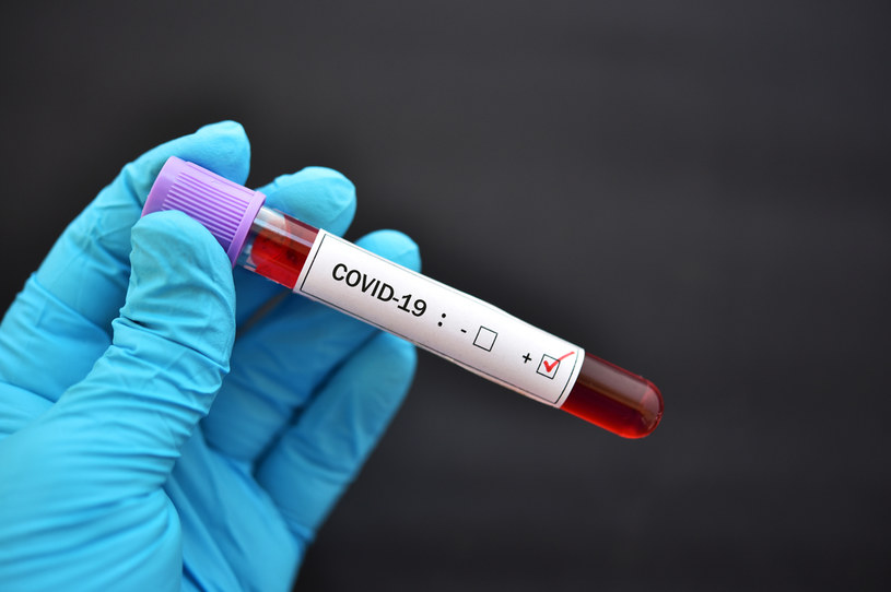 Fiskus nie weźmie PIT od testów na koronawirusa /123RF/PICSEL