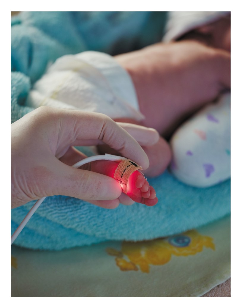 Fotografie przedstawiają dzieci urodzone przed 36. tygodniem ciąży przebywające na oddziałach intensywnej terapii noworodka /materiały prasowe