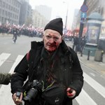 Fotoreporter postrzelony w czasie Marszu Niepodległości. Sąd odrzucił zażalenie