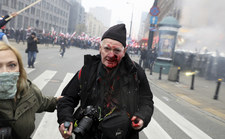 Fotoreporter "Tygodnika Solidarność" postrzelony podczas Marszu Niepodległości
