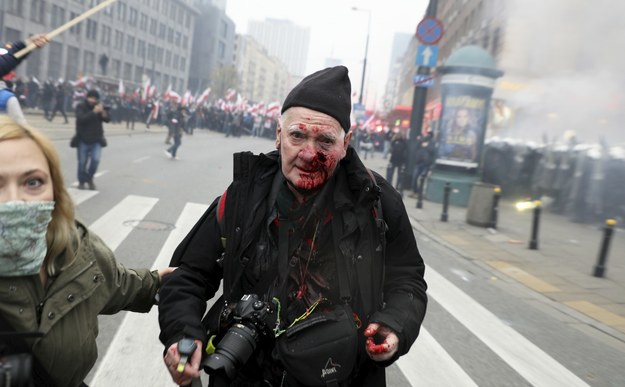 Fotoreporter został ranny w trakcie Marszu Niepodległości 2020 /Jakub Kamiński   /East News