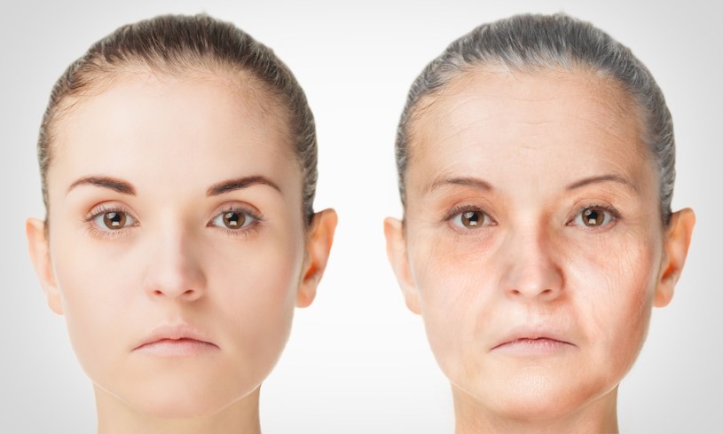 Fotostarzenie się skóry powoduje nieodwracalne zmiany w tkankach /123RF/PICSEL