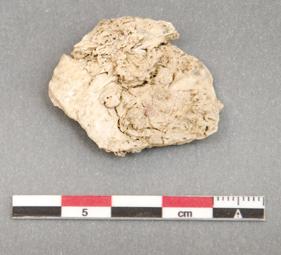 Fragment czaszki z widocznymi na niej zmianami /foto. Muzeum Miedzi w Legnicy /