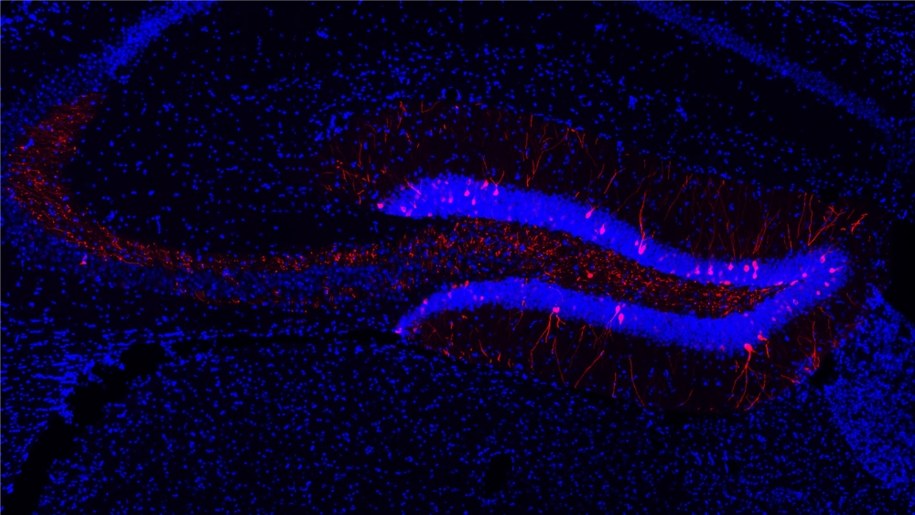 Fragment hipokampa myszy. Na czerwono oznaczone są neurony uczestniczące w badanym procesie uczenia się /Havekes l\Lab / University of Groningen /Materiały prasowe