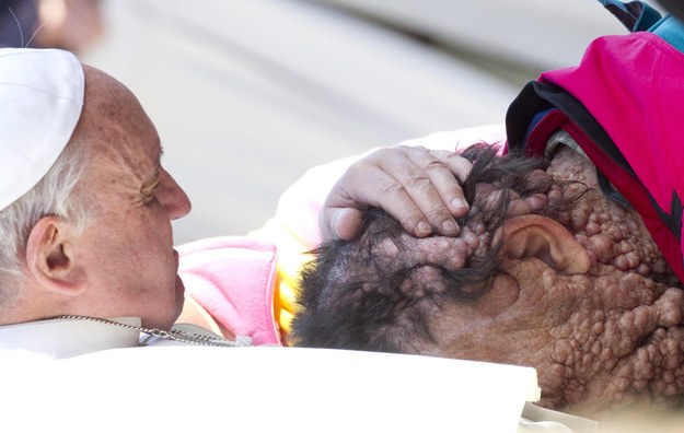 Franciszek we współczującym geście wobec chorej osoby /CLAUDIO PERI /PAP/EPA
