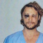 Gabriel Aubry po bójce z Martinezem 