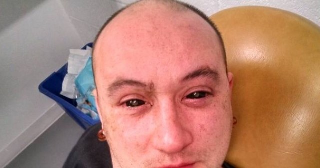 Gabriel Licina przyznał, że wstrzyknięta substancja chemiczna powodowała ból oczu. Fot. Science of the Masses. /Tylkonauka.pl