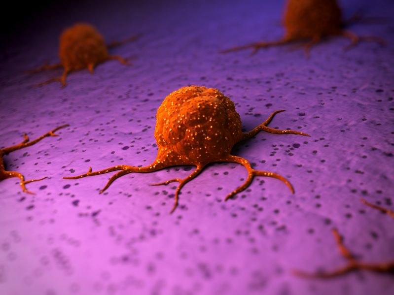 Gdy komórki nowotworowe zaczynają tworzyć przerzuty, zazwyczaj jest już za późno na wyleczenie /123RF/PICSEL