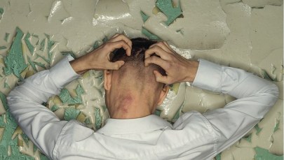 "Gdy skóra bardzo mocno swędzi". Co warto wiedzieć o AZS?