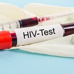 Gdzie zgłosić się, by wykonać test na HIV?