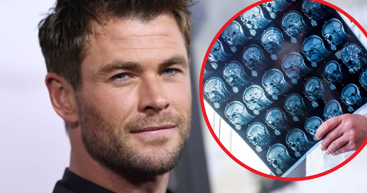 "Gen alzheimera" ma m.in. Aktor Chris Hemsworth. Z tego powodu przerwał karierę. Chce skupić się na zdrowiu i rodzinie /ANGELA WEISS/AFP /123RF/PICSEL