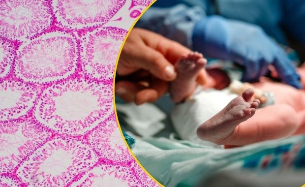 Genetyczna pułapka w banku spermy. Blisko 200 dzieci w Europie zagrożone rakiem 