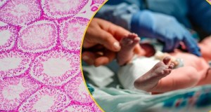 Genetyczna pułapka w banku spermy. Blisko 200 dzieci w Europie zagrożone rakiem 