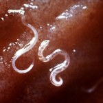 leki Genetycznie zmodyfikowane pasożyty mogą leczyć ludzi. Przełomowe badania