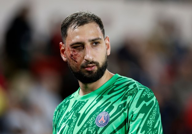 Gianluigi Donnarumma ze zmasakrowaną twarzą /Sebastian Nogier /PAP/EPA