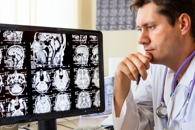 Głęboka stymulacja mózgu pomoże wyleczyć Alzheimera? /123RF/PICSEL