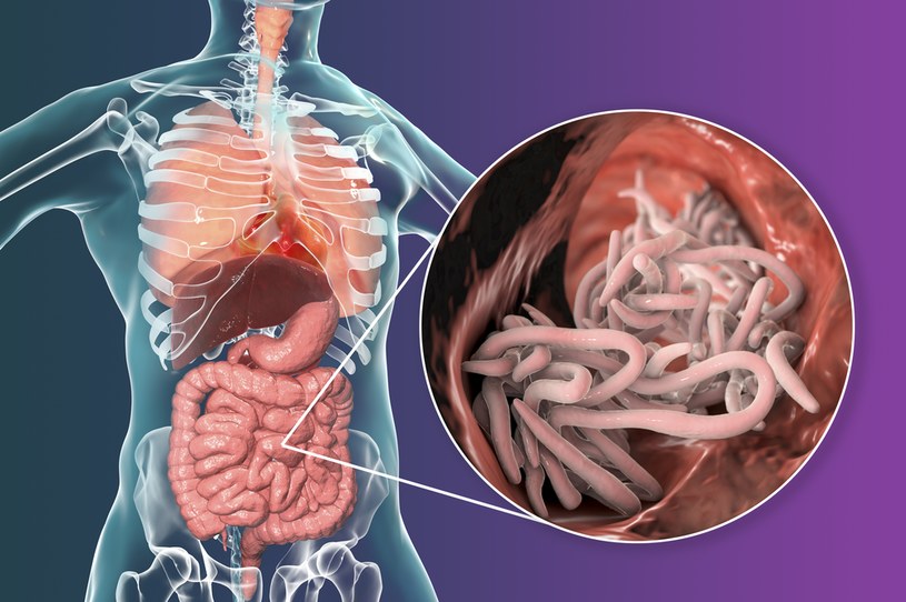 Glista ludzka to popularny pasożyt. Żywi się m.in. cukrem, więc w diecie odrobaczającej organizm trzeba go ograniczyć do minimum /123RF/PICSEL