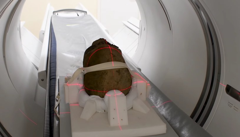 Głowa egipskiej mumii została przebadana wykorzystując tomografię komputerową /Zrzut ekranu/ Mummified head and cat CT scan full video/ Maidstone and Tunbridge Wells NHS Trust /YouTube