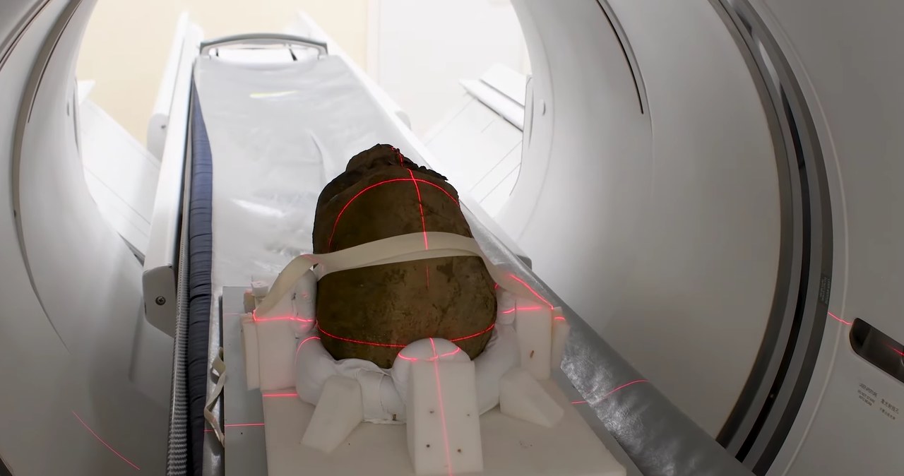 Głowa egipskiej mumii została przebadana wykorzystując tomografię komputerową /Zrzut ekranu/ Mummified head and cat CT scan full video/ Maidstone and Tunbridge Wells NHS Trust /YouTube