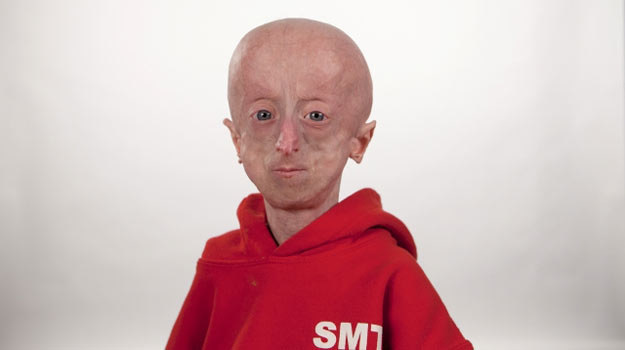 Główny bohater dokumentu HBO, Sam Berns, chorował na progerię. /HBO