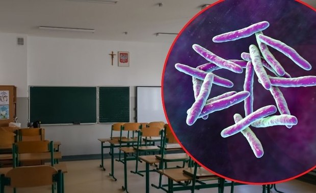 Groźna choroba w szkole. Sanepid uspokaja