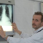 Groźny rak płuca