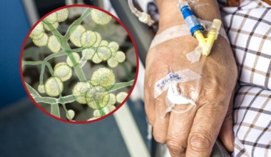 Grzyb atakuje krew, mocz i skórę. Zakażenie zabija połowę chorych