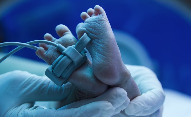 Guz był dwukrotnie większy od noworodka. Lekarze mówią o cudzie