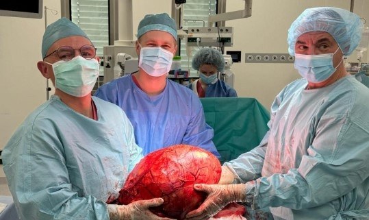 Guz nerki ważył 14 kg /copernicus.gda.pl/ /Materiały prasowe