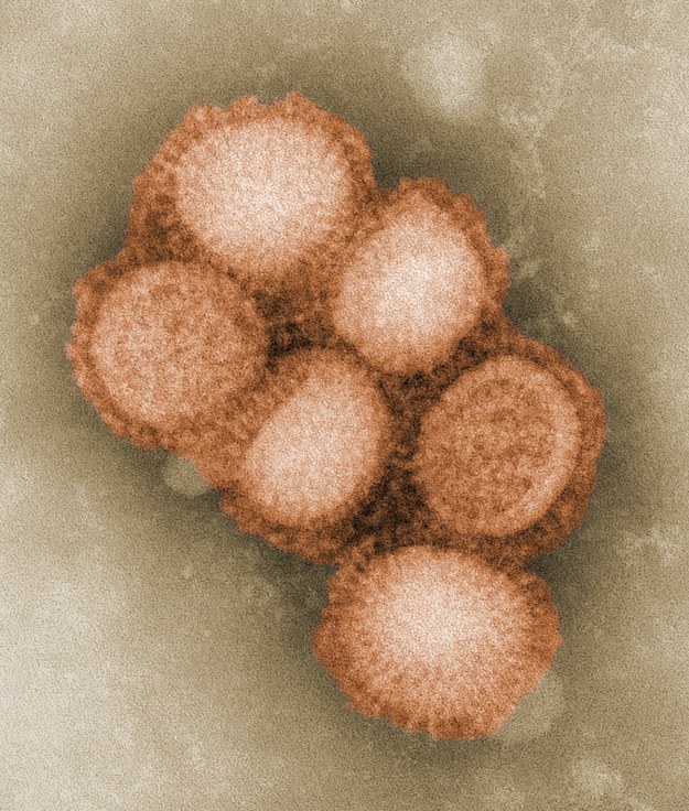 H1N1 - wirus świńskiej grypy, który spowodował epidemię 2009 roku (fot.CDC) /&nbsp