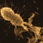 HAMLET poradzi sobie z wyjątkowo zjadliwymi bakteriami