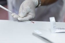 HCV groźniejszy niż inne wirusy. Jak się chronić przed cichym zabójcą?