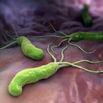 Helicobacter Pylori - niechciany lokator