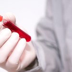 Hemoglobina - jaka norma, co wpływa na stężenie?