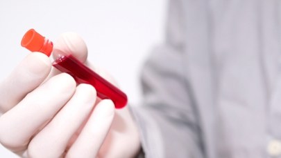 Hemoglobina - jaka norma, co wpływa na stężenie?