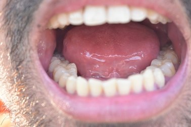Higiena jamy ustnej. Jak wpływa na nasze zdrowie?