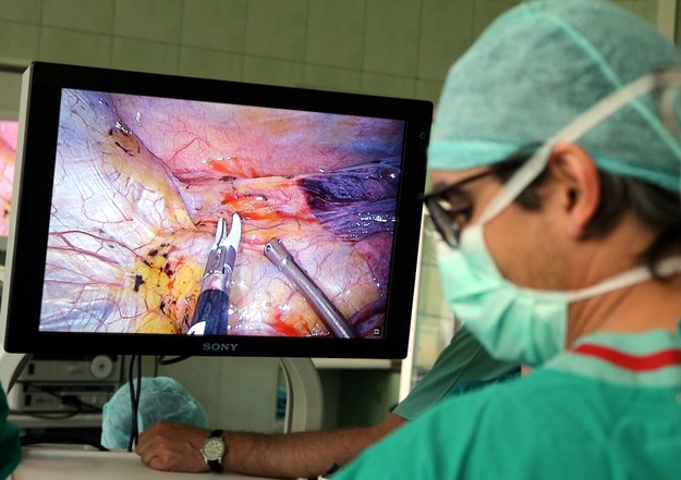 Hiszpański chirurg dr Diego Gonzalez Rivas podczas operacji wycięcia niedużego guza płuc /Grzegorz Momot /PAP