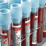 HIV i AIDS - czym się od siebie różnią? 