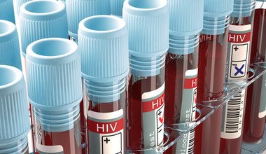 HIV i AIDS - czym się od siebie różnią? 