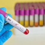 HIV - na co uważać?