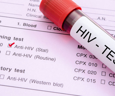 HIV - wirus groźniejszy niż SARS-CoV-2